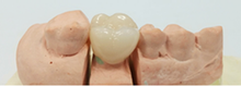 Load image into Gallery viewer, Vatech Perfit FS Fully Sintered Zirconia Block