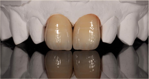 Vatech Multilayer TSML Zirconia milling Disc.